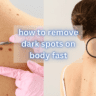 how to remove dark spots on body fast